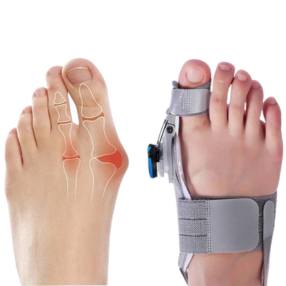 Natural Bunions Corrector Toe
Spacer