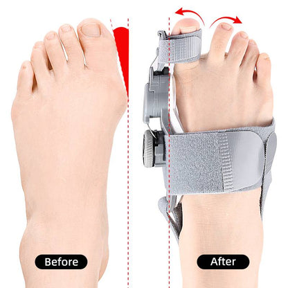 Natural Bunions Corrector Toe
Spacer