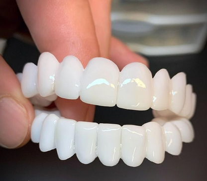 Dental prosthesis