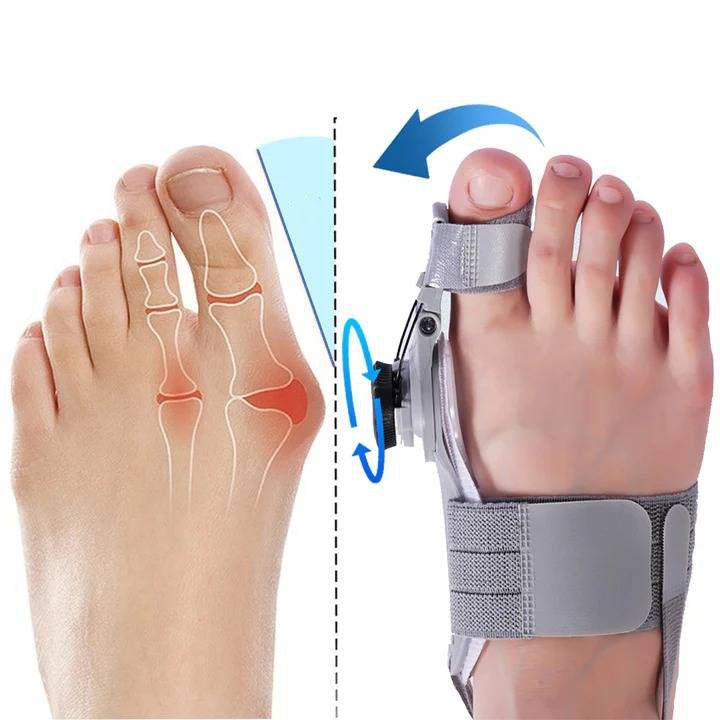Natural Bunions Corrector Toe
Spacer