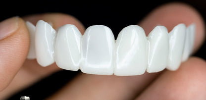 Dental prosthesis